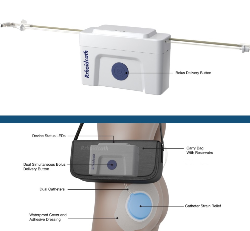 rrhoidcath-render-diagram-2025